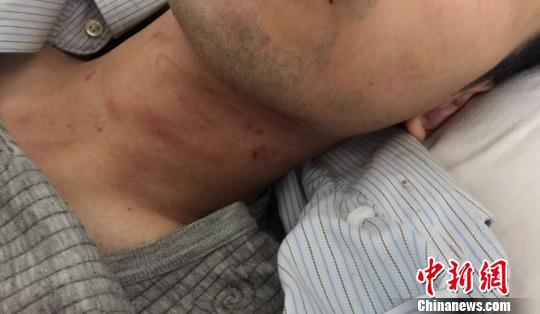 ͼΪ���˵�лĳ������������